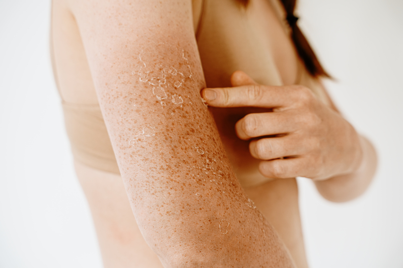 Dry Skin After 30? It Might Be Hormones