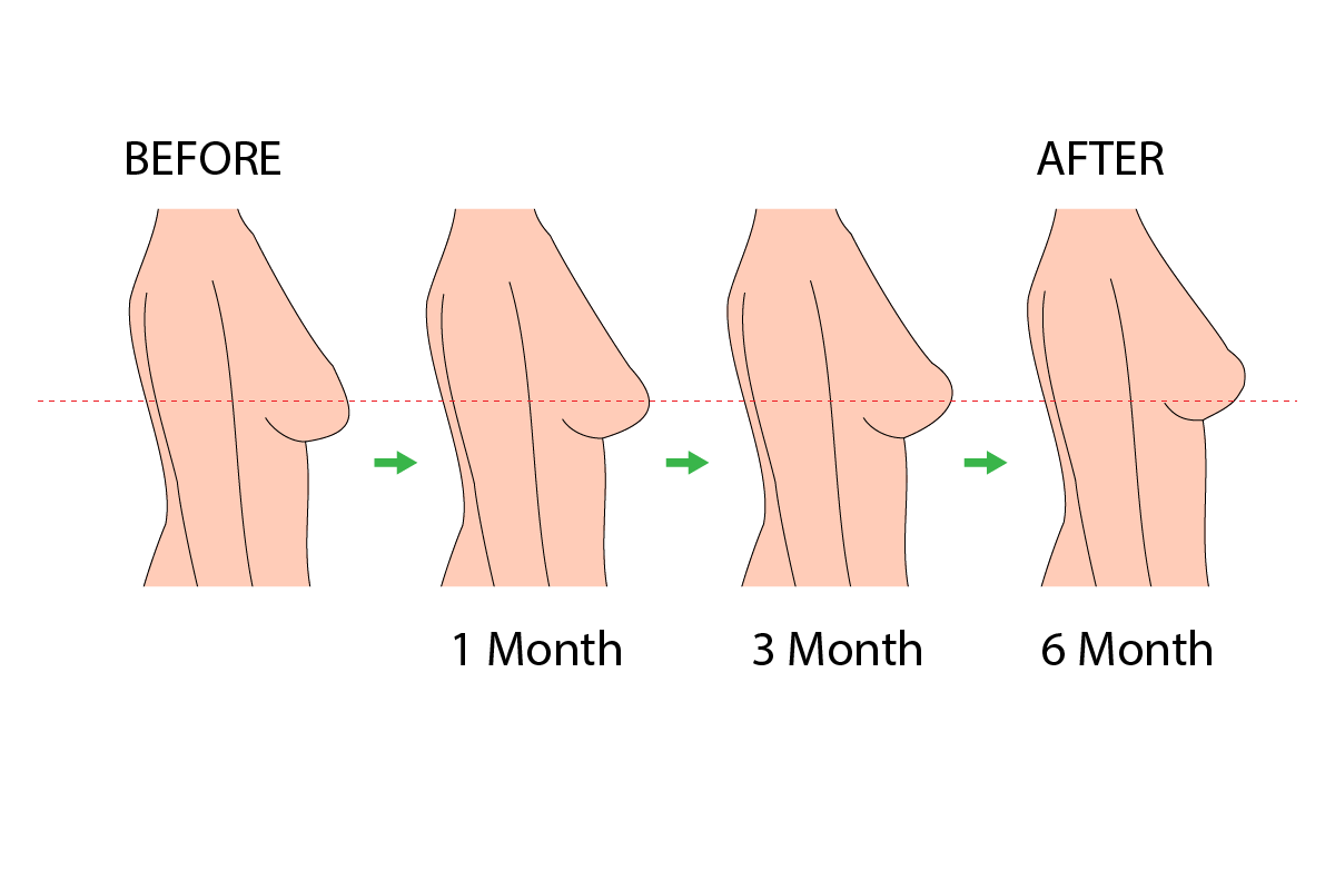 Before and After Results